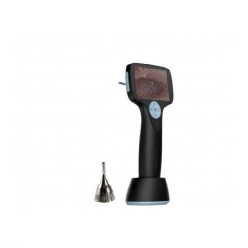 Otoscope vidéo DIGISKOP AUG HD – Réf. VCLICK30